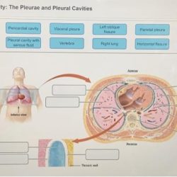 Art-labeling activity: the pleurae and pleural cavities